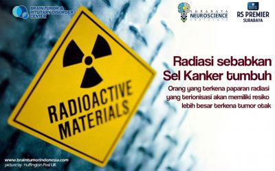 Paparan Radiasi Penyebab Tumor Otak