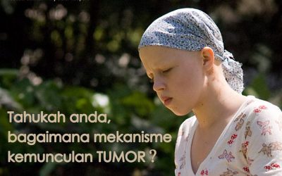 Faktor Risiko Tumor Otak