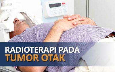 Radioterapi Pada Tumor Otak