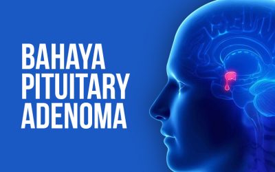 Bahaya Pituitary Adenoma