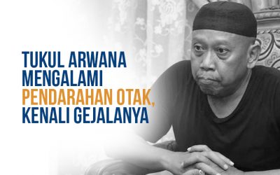 Tukul Arwana Alami Pendarahan Otak, Kenali Gejalanya