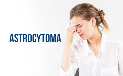 Astrocytoma: Penyebab, Gejala, serta Penanganan