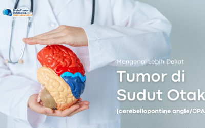 Mengenal Lebih Dekat Tumor di Sudut Otak