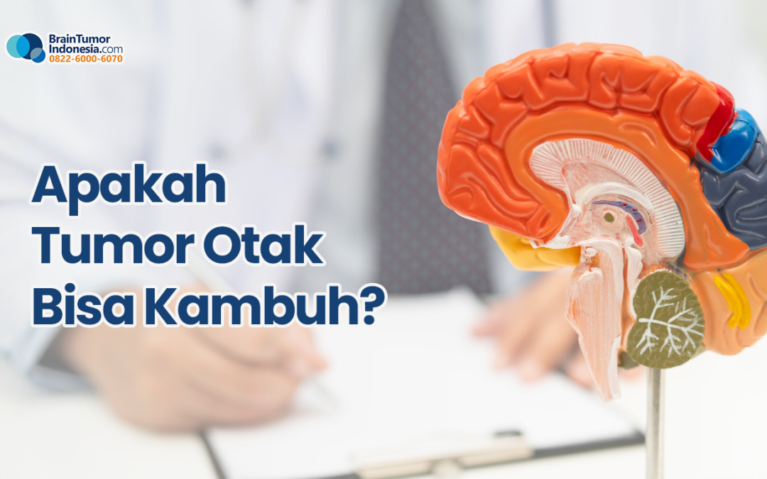 Apakah Tumor Otak Dapat Kambuh?