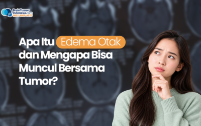 Apa Itu Edema Otak dan Mengapa Bisa Muncul Bersama Tumor?